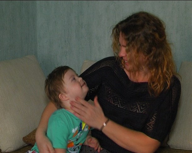 Ребенок с мозаичным синдромом дауна
