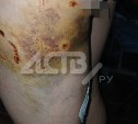 Стая агрессивных собак порвала ногу женщине в Холмске