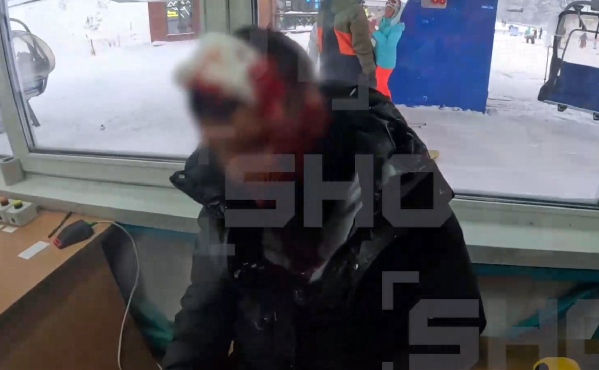 Турист получил серьёзную травму головы на СТК "Горный Воздух"