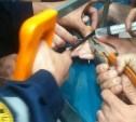 Ножовкой по металлу снимали кольцо с пальца ребенка в Южно-Сахалинске