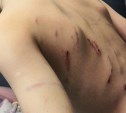 Случаем нападения собак на мальчика возле мэрии в Ногликах заинтересовался федеральный следком
