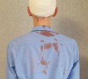 Прокуратура Южно-Сахалинска проверяет ситуацию с избиением школьника