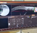 "Заметит мельчайшие изменения": в областной больнице поставили аппараты КТ для глаз