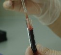 ВИЧ-инфекцию выявили у 75 жителей Сахалинской области за четыре месяца
