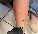 В Поронайске уличная собака укусила семилетнего ребёнка у здания автовокзала