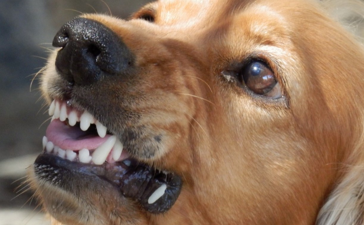 Чипированные собаки на Камчатке набросились на девочку