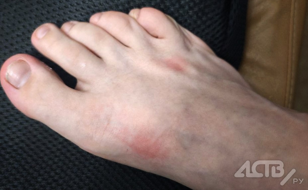 Вторым пострадавшим от порыва на сетях в Южно-Сахалинске стал ребёнок