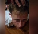 Сахалинцу, задавившему 19-летнего парня в Дачном, утвердили обвинение