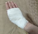 "Хозяева только хамят": собака на самовыгуле покусала прохожего в Охе 