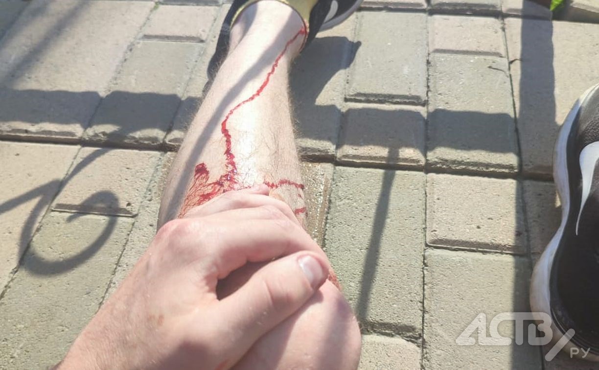 Хлынула "чёрная" кровь: южносахалинец рассказал, как в него на скорости 30 км/ч въехал велосипедист