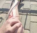 Хлынула "чёрная" кровь: южносахалинец рассказал, как в него на скорости 30 км/ч въехал велосипедист