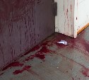 Хорошо одетый парень ночью истекал кровью у одного из домов в Южно-Сахалинске