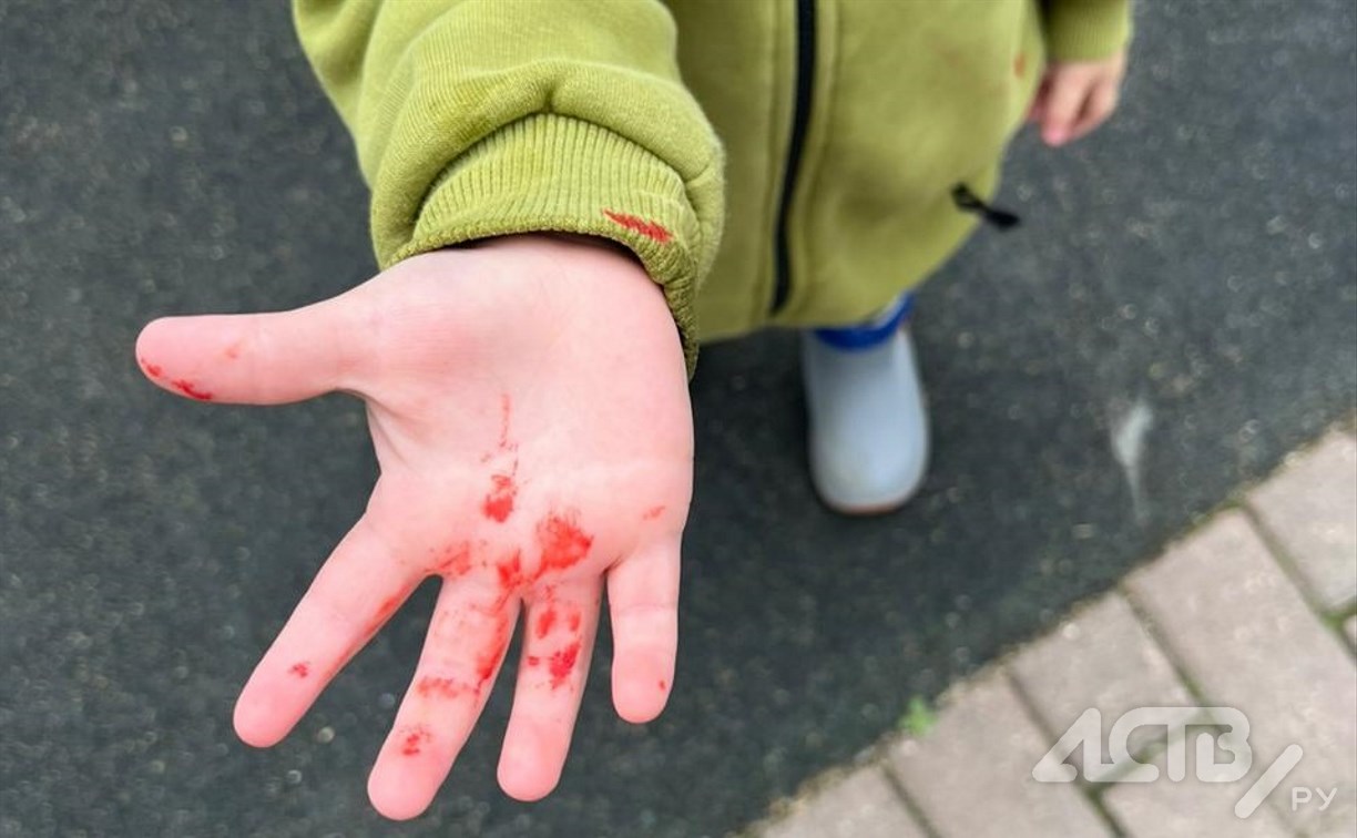 В Корсакове дети испачкались краской, родители требуют ответственности от коммунальщиков