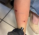 Срочный отлов организовали в Поронайске после нападения собаки на ребёнка