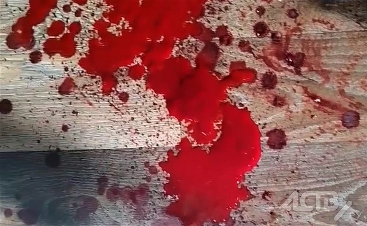 Разбил голову молотком: мстительный житель Южно-Сахалинска устроил кровавую разборку с соседом 