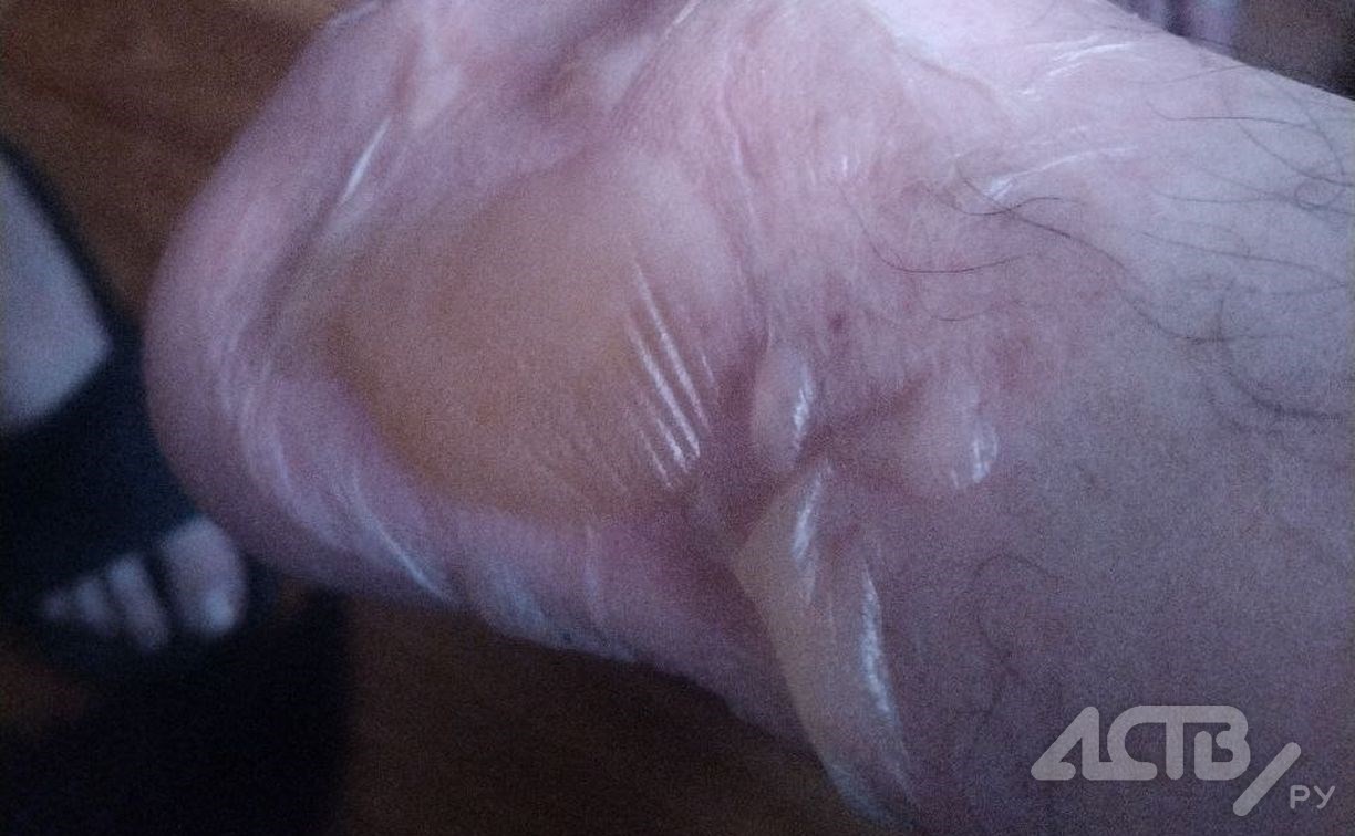 Южносахалинец получил ожоги ноги, пробежавшись по кипятку на месте порыва теплотрассы