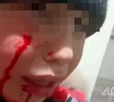 Прокуратура контролирует ход и результаты дело о нападении собаки в Чапланово 