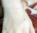 Хозяин собаки, которая укусила за руку школьника в Долинске, заплатит 35 000 пострадавшему