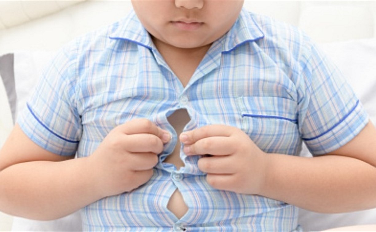 Статистика: в России в 6 раз выросла заболеваемость ожирением у подростков