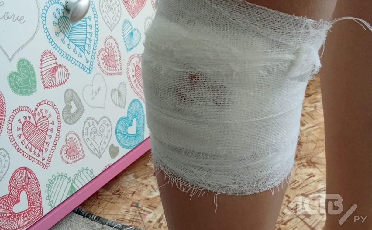 Домашняя собака напала на семилетнюю девочку в парке в Долинске