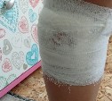 Домашняя собака напала на семилетнюю девочку в парке в Долинске