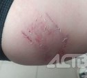На Сахалине бездомные псы напали на девушку 