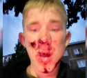 “Закидывали булыжниками и угрожали порезать”: толпа избила и обокрала подростка в Южно-Сахалинске 