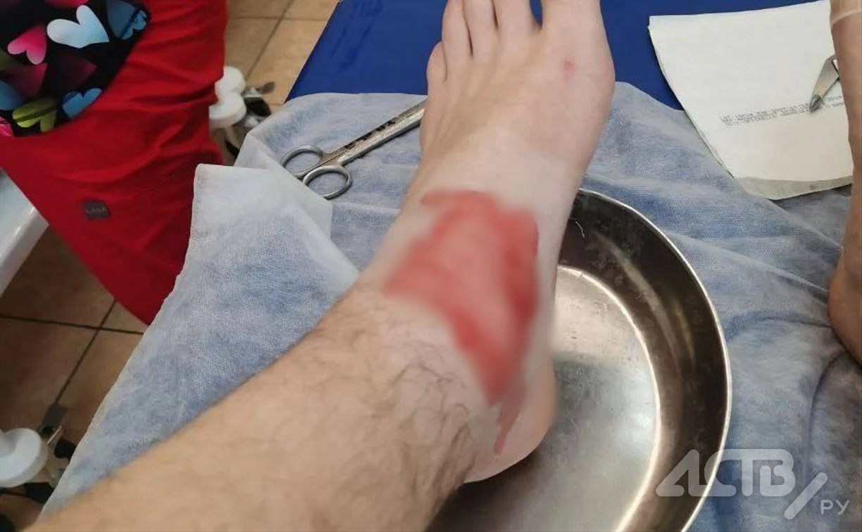 Бастрыкин затребовал доклад по делу о подростках с ожогами после коммунальной аварии на Сахалине 