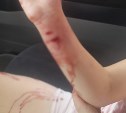 Десятилетнюю девочку укусила бездомная собака в Холмске