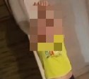 По сообщению об истязании малолетнего сахалинский следком возбудил уголовное дело