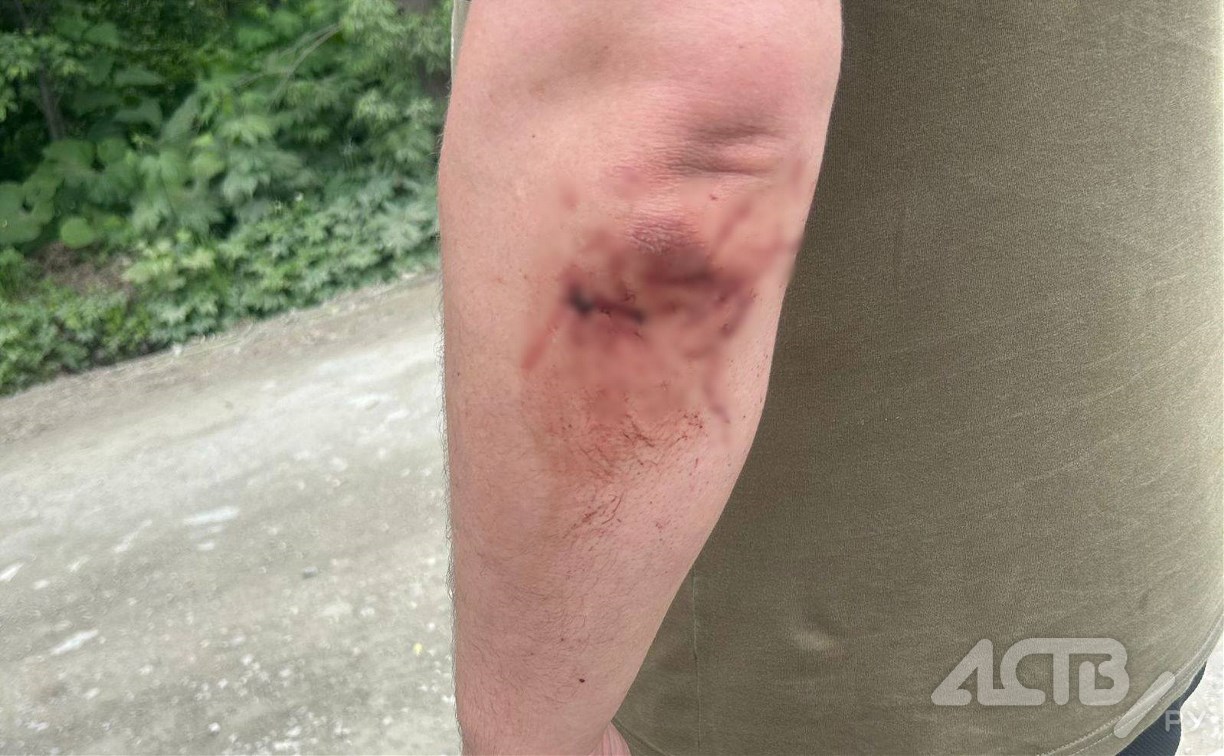  "Повезло, что не в голову": на Сахалине камень из-под косилки выбил окно грузовика, осколки ранили водителя 