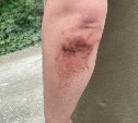  "Повезло, что не в голову": на Сахалине камень из-под косилки выбил окно грузовика, осколки ранили водителя 