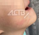 Сахалинский омбудсмен подключила полицию и чиновников к истории с девочкой, которую напугали в детсаду