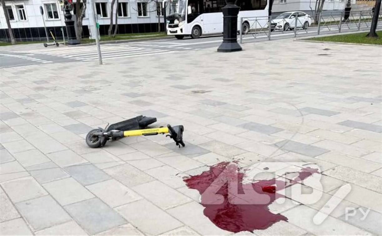 Самокатчик упал и получил травму головы в Южно-Сахалинске