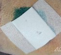Уголовное дело возбудили после того, как в Дальнем на женщину напала собака