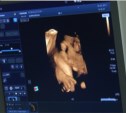 Рассмотреть лицо ребенка в деталях теперь смогут беременные сахалинки
