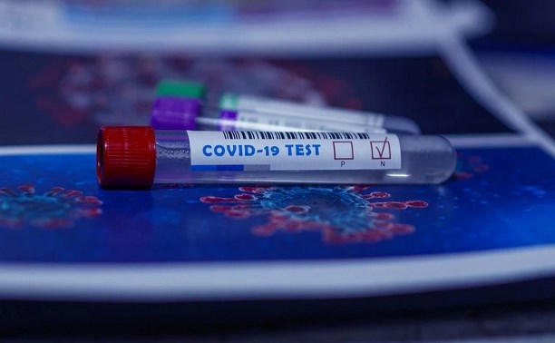 Врачи диагностировали 123 новых случая заражения COVID-19
