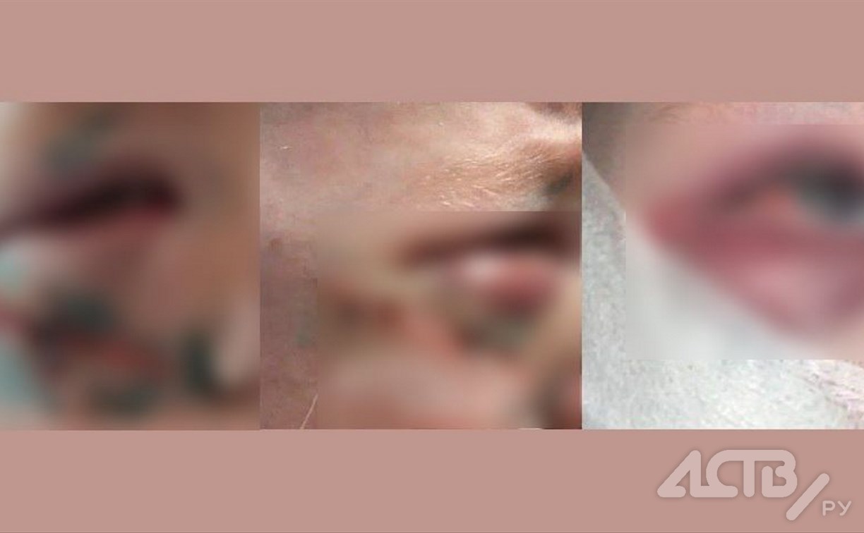 В Южно-Сахалинске продолжают искать самокатчика, сбившего 3-летнего малыша