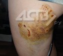 Нападение агрессивных собак на сахалинку дошло до уголовного дела