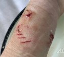 На Сахалине проводится проверка по факту нападения собаки на женщину в Невельске
