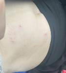Собака порвала руку защищавшей детей сахалинке, Фото: 3