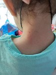  Южносахалинка: "Воспитатель хватала мою дочь за шею руками", Фото: 5