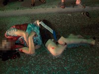 Мопедист и его пассажирка попали в реанимацию в результате ДТП в Корсакове, Фото: 3