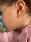  Южносахалинка: "Воспитатель хватала мою дочь за шею руками", Фото: 2