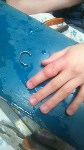 Ножовкой по металлу снимали кольцо с пальца ребенка в Южно-Сахалинске, Фото: 3